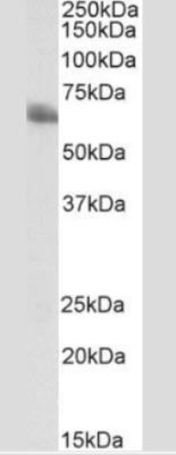 TEM8/ANTXR1 Antibody (200C1339(SB20)) - Azide and BSA Free, Novus Biologicals