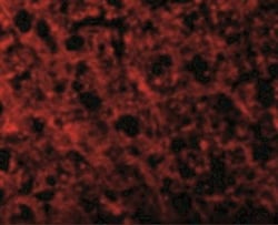 TEM8/ANTXR1 Antibody, Novus Biologicals:Anticuerpos:Anticuerpos primarios