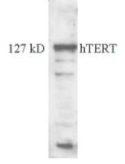 TERT Antibody (2C4), Novus Biologicals 0.025mL; Unlabeled:Antibodies, Monoclonal