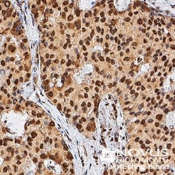 TERT Antibody (2D8), Novus Biologicals 0.025mL; Unlabeled:Antibodies, Monoclonal