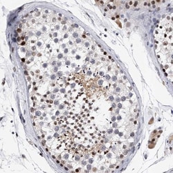 TESK2 Antibody, Novus Biologicals 25 &mu;L; Unlabeled:Antibodies, Polyclonal