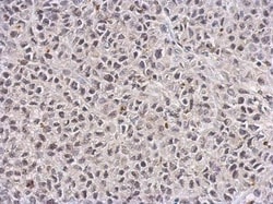 TET1 Antibody (1462), Novus Biologicals 0.1mL; Unlabeled:Antibodies, Monoclonal