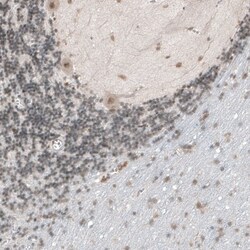 TET1 Antibody, Novus Biologicals 25 μL; Unlabeled:Antibodies, Polyclonal