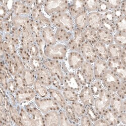 TET1 Antibody, Novus Biologicals 25 μL; Unlabeled:Antibodies, Polyclonal