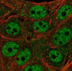 TET3 Antibody, Novus Biologicals:Antibodies:Primary Antibodies