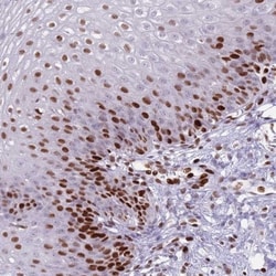 TETRAN Antibody, Novus Biologicals 0.1mL; Unlabeled:Antibodies, Polyclonal