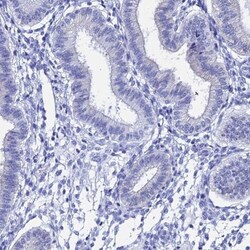 TEX101 Antibody, Novus Biologicals 0.1mL; Unlabeled:Antibodies, Polyclonal