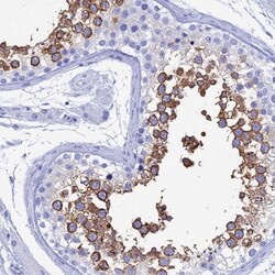 TEX101 Antibody, Novus Biologicals 0.1mL; Unlabeled:Antibodies, Polyclonal