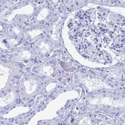 TEX101 Antibody, Novus Biologicals 0.1mL; Unlabeled:Antibodies, Polyclonal