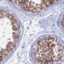 TEX101 Antibody, Novus Biologicals 0.1mL; Unlabeled:Antibodies, Polyclonal