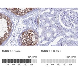 TEX101 Antibody, Novus Biologicals 0.1mL; Unlabeled:Antibodies, Polyclonal