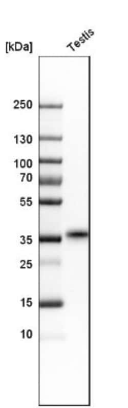 TEX101 Antibody, Novus Biologicals 0.1mL; Unlabeled:Antibodies, Polyclonal