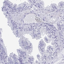 TEX12 Antibody, Novus Biologicals 25 &mu;L, Unlabeled:Antibodies, Polyclonal