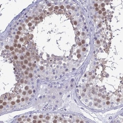 TEX12 Antibody, Novus Biologicals 25 &mu;L, Unlabeled:Antibodies, Polyclonal