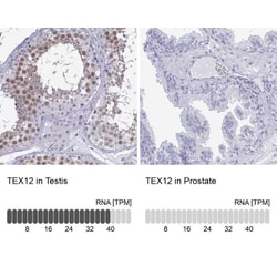 TEX12 Antibody, Novus Biologicals 25 &mu;L, Unlabeled:Antibodies, Polyclonal