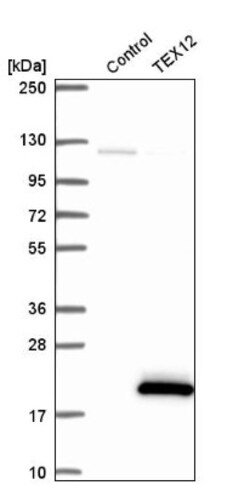 TEX12 Antibody, Novus Biologicals 25 &mu;L, Unlabeled:Antibodies, Polyclonal
