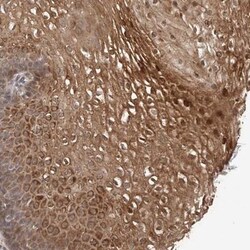 TEX13B Antibody, Novus Biologicals 25 &mu;L; Unlabeled:Antibodies, Polyclonal