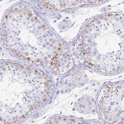 TEX19 Antibody, Novus Biologicals 0.1mL; Unlabeled:Antibodies, Polyclonal