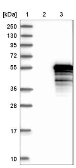 TEX9 Antibody, Novus Biologicals 25 &mu;L; Unlabeled:Antibodies, Polyclonal