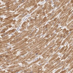 TFB2M Antibody, Novus Biologicals 0.1mL; Unlabeled:Antibodies, Polyclonal