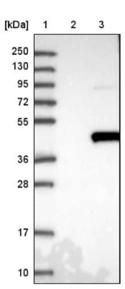TFB2M Antibody, Novus Biologicals 0.1mL; Unlabeled:Antibodies, Polyclonal