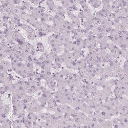 TFF1/pS2 Antibody, Novus Biologicals 0.1mL; Unlabeled:Antibodies, Polyclonal