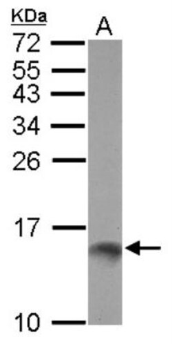 TFF1/pS2 Antibody, Novus Biologicals 0.1mL; Unlabeled:Antibodies, Polyclonal