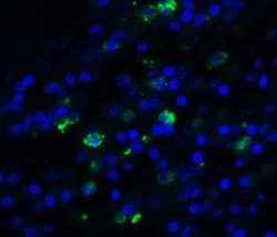 TFF3 Antibody - BSA Free, Novus Biologicals 0.1mg; Unlabeled:Antibodies,