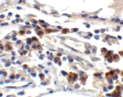 TFF3 Antibody - BSA Free, Novus Biologicals 0.1mg; Unlabeled:Antibodies,