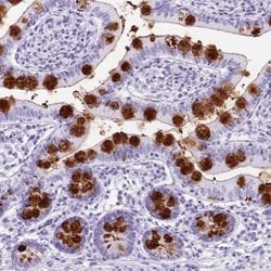 TFF3 Antibody, Novus Biologicals 0.1mL; Unlabeled:Antibodies, Polyclonal