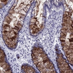 TFF3 Antibody, Novus Biologicals 0.1mL; Unlabeled:Antibodies, Polyclonal