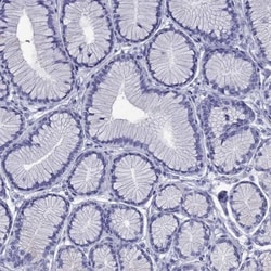 TFF3 Antibody, Novus Biologicals 0.1mL; Unlabeled:Antibodies, Polyclonal