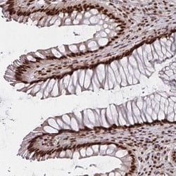 TFIIB Antibody, Novus Biologicals:Antibodies:Primary Antibodies