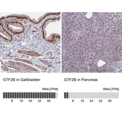 TFIIB Antibody, Novus Biologicals:Antibodies:Primary Antibodies