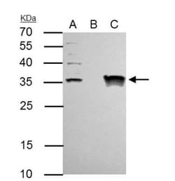 TFIIE beta Antibody, Novus Biologicals 0.1mL; Unlabeled:Antibodies, Polyclonal