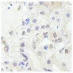 TFIIIC Antibody, Novus Biologicals 0.1mg; Unlabeled:Antibodies, Polyclonal