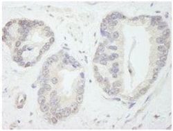 TFIIIC Antibody, Novus Biologicals 0.1mg; Unlabeled:Antibodies, Polyclonal