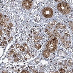 TFIIIC Antibody, Novus Biologicals 0.1mL; Unlabeled:Antibodies, Polyclonal