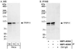 TFIP11 Antibody, Novus Biologicals 0.1mL; Unlabeled:Antibodies, Polyclonal