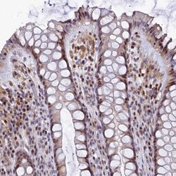 TGDS Antibody, Novus Biologicals:Antibodies:Primary Antibodies