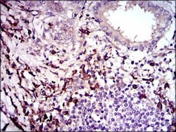 LAP (TGF-beta 1) Antibody (7F6) - BSA Free, Novus Biologicals:Antibodies:Primary