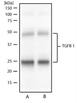 LAP (TGF-beta 1) Antibody (7F6) - BSA Free, Novus Biologicals:Antibodies:Primary
