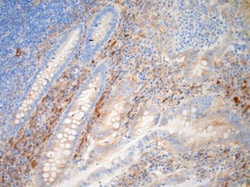 TGF-beta 1 Antibody, Novus Biologicals 0.05mg; Unlabeled:Antibodies, Polyclonal