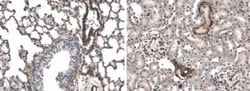 TGF-beta RI/ALK-5 Antibody (RM0016-3A11) - Azide and BSA Free, Novus Biologicals:Antibodies:Primary