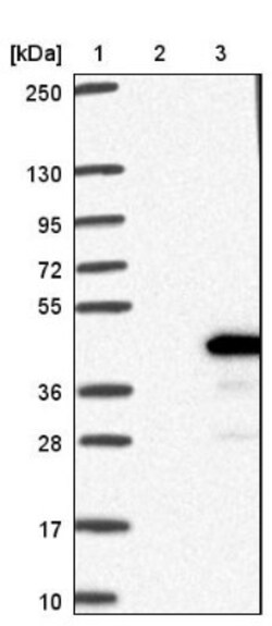 THAP10 Antibody, Novus Biologicals 0.1mL; Unlabeled:Antibodies, Polyclonal
