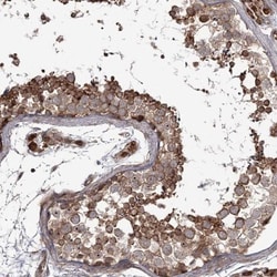 THAP9 Antibody, Novus Biologicals:Antibodies:Primary Antibodies