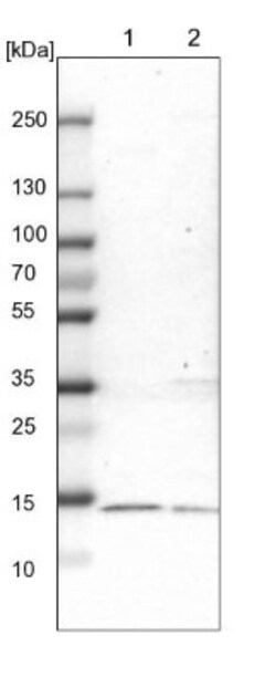 THEM2 Antibody, Novus Biologicals 0.1mL; Unlabeled:Antibodies, Polyclonal