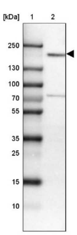 THOC2 Antibody, Novus Biologicals 25 &mu;L, Unlabeled:Antibodies, Polyclonal