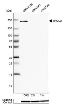 THOC2 Antibody, Novus Biologicals 25 &mu;L, Unlabeled:Antibodies, Polyclonal