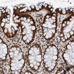 THRAP3 Antibody, Novus Biologicals 0.1 mL | Buy Online | Novus Biologicals | Fisher Scientific